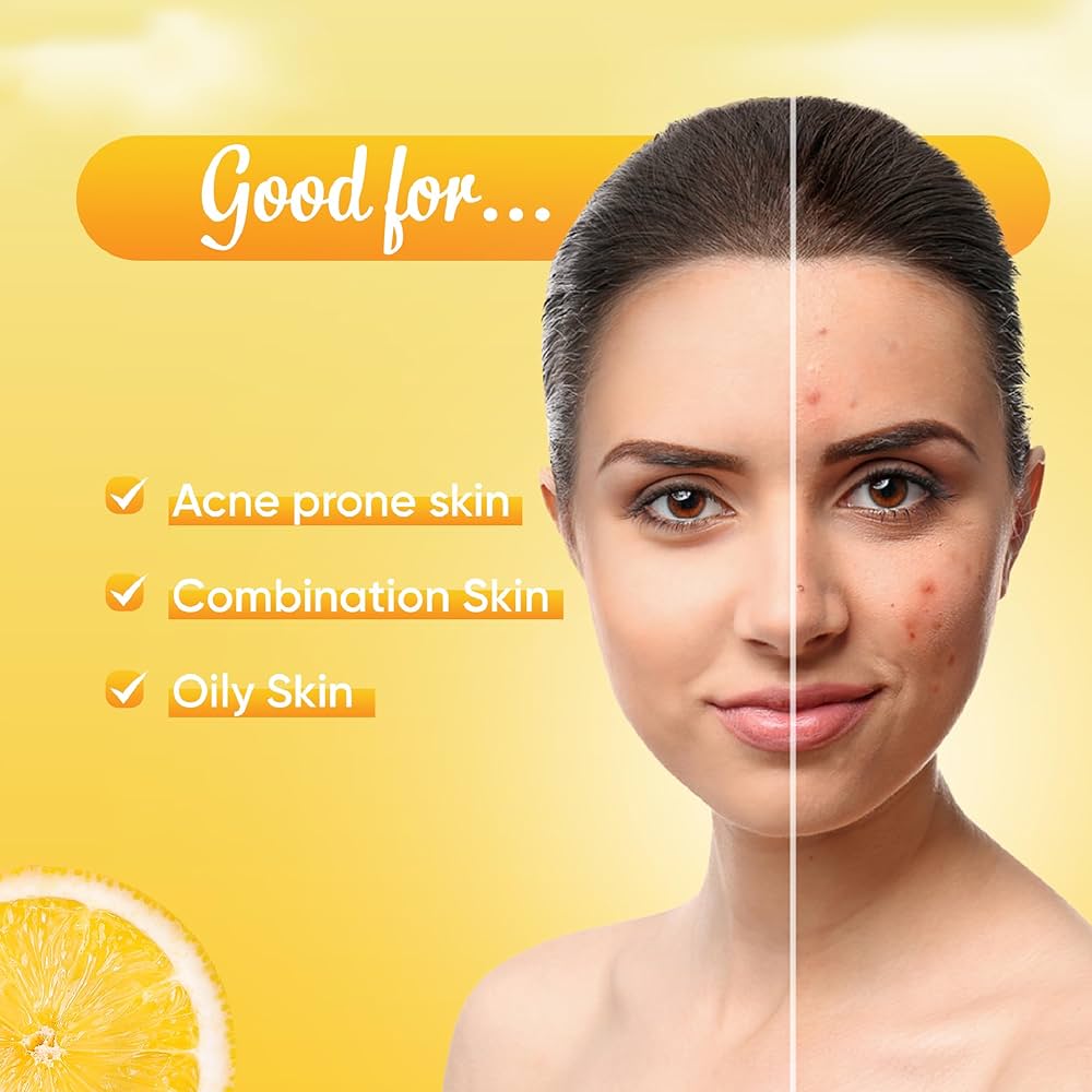 Ozone acne check face wash